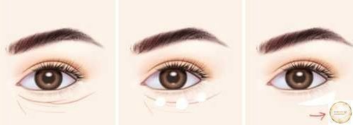 Антивіковий крем для повік з пептидами W.SKIN LABORATORY Peptide Eye Cream - 30 мл wskin001 фото