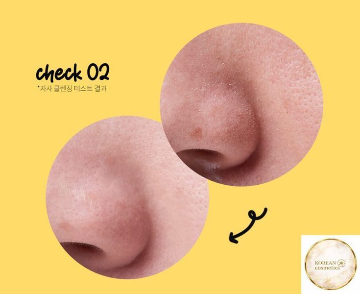 Педи гідрофільні для очищення шкіри з AHA BHA PHA кислотами Manyo Blackhead Kill Pad 50 ea manyo001 фото