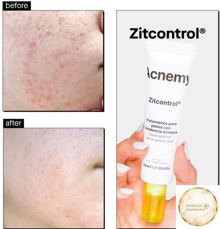 Крем Для Проблемної Шкіри ZITCONTROL 40 Ml acnemy008 фото